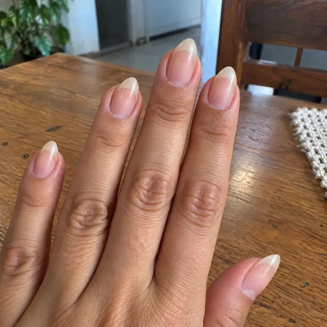 Depois: unhas mais longas e resistentes