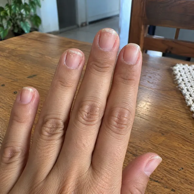 Antes: unhas fracas e quebradiças